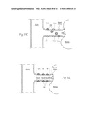 APPARATUS, SYSTEMS, AND METHODS FOR ACHIEVING INTRAVASCULAR, THERMALLY-INDUCED RENAL NEUROMODULATION diagram and image