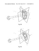 Hip surgery assembly diagram and image