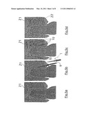 BONE REGENERATION DEVICE diagram and image