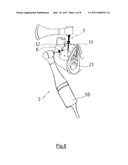 BONE REGENERATION DEVICE diagram and image