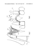 BONE REGENERATION DEVICE diagram and image