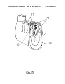 BONE REGENERATION DEVICE diagram and image