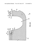 PLACING SUTURES diagram and image