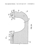 PLACING SUTURES diagram and image