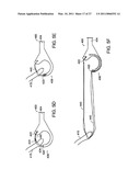 PLACING SUTURES diagram and image