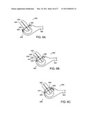 PLACING SUTURES diagram and image