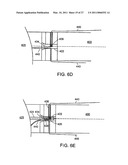 PLACING SUTURES diagram and image