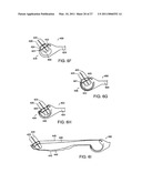 PLACING SUTURES diagram and image