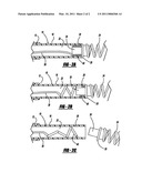 Embolic Device Delivery System With Retractable Partially Coiled-Fiber Release diagram and image