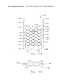 SURGICAL STAPLES HAVING COMPRESSIBLE OR CRUSHABLE MEMBERS FOR SECURING TISSUE THEREIN AND STAPLING INSTRUMENTS FOR DEPLOYING THE SAME diagram and image