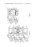 EXPANDABLE INTRODUCER SYSTEM AND METHODS diagram and image