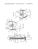 EXPANDABLE INTRODUCER SYSTEM AND METHODS diagram and image