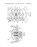 EXPANDABLE INTRODUCER SYSTEM AND METHODS diagram and image