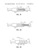 MEDICAL INSTRUMENTS FOR DIAPLASIS diagram and image