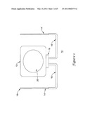 Anterior Active Housing Subcutaneous Positioning Methods diagram and image