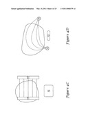 Anterior Active Housing Subcutaneous Positioning Methods diagram and image