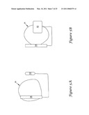 Anterior Active Housing Subcutaneous Positioning Methods diagram and image