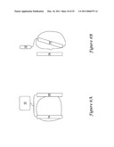 Anterior Active Housing Subcutaneous Positioning Methods diagram and image