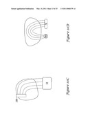 Anterior Active Housing Subcutaneous Positioning Methods diagram and image