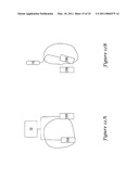 Anterior Active Housing Subcutaneous Positioning Methods diagram and image