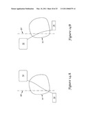 Anterior Active Housing Subcutaneous Positioning Methods diagram and image