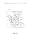 STIMULATION OF A STIMULATION SITE WITHIN THE NECK OR HEAD diagram and image