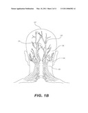 STIMULATION OF A STIMULATION SITE WITHIN THE NECK OR HEAD diagram and image