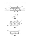 Implantable Microstimulators diagram and image