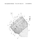 ENDOPROSTHESIS WITH FILAMENT REPOSITIONING OR RETRIEVAL MEMBER AND GUARD STRUCTURE diagram and image