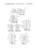 ENDOPROSTHESIS WITH FILAMENT REPOSITIONING OR RETRIEVAL MEMBER AND GUARD STRUCTURE diagram and image