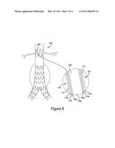 SURFACE STRUCTURE OF A COMPONENT OF A MEDICAL DEVICE AND A METHOD OF FORMING THE SURFACE STRUCTURE diagram and image