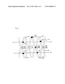 Tubular Supporting Prosthesis Capable of Growing diagram and image