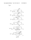 Tubular Supporting Prosthesis Capable of Growing diagram and image