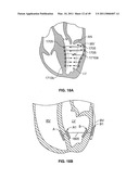 METHODS, SYSTEMS AND DEVICES FOR CARDIAC VALVE REPAIR diagram and image