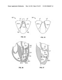 METHODS, SYSTEMS AND DEVICES FOR CARDIAC VALVE REPAIR diagram and image