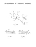 METHODS, SYSTEMS AND DEVICES FOR CARDIAC VALVE REPAIR diagram and image