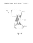 METHODS, SYSTEMS AND DEVICES FOR CARDIAC VALVE REPAIR diagram and image