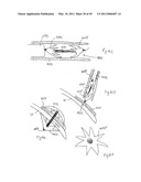 METHODS, SYSTEMS AND DEVICES FOR CARDIAC VALVE REPAIR diagram and image