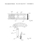 METHODS, SYSTEMS AND DEVICES FOR CARDIAC VALVE REPAIR diagram and image