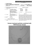 Tissue Engineered Meniscus Repair Composition diagram and image