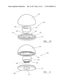 INSTRUMENT FOR USE IN A JOINT REPLACEMENT PROCEDURE diagram and image