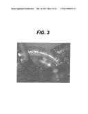 MEDICAL DEVICES WITH GALVANIC PARTICULATES diagram and image