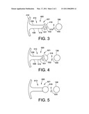 Pre-Chamber Spark Plug and Electrodes Therefor diagram and image