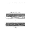 System to Screen for Longitudinal-Seam Anomalies diagram and image