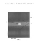 System to Screen for Longitudinal-Seam Anomalies diagram and image