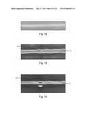 System to Screen for Longitudinal-Seam Anomalies diagram and image