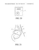 DETACHABLE ANTENNA FOR REMOTE BAND diagram and image