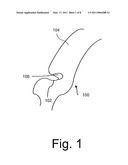 Systems and Methods for Computer-aided Fold Detection diagram and image