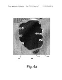 Systems and Methods for Computer-aided Fold Detection diagram and image