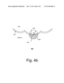 Systems and Methods for Computer-aided Fold Detection diagram and image